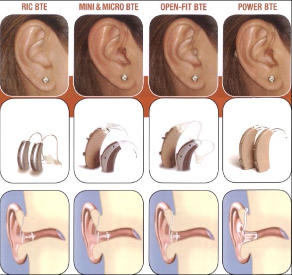 widex behind ear hearing aids