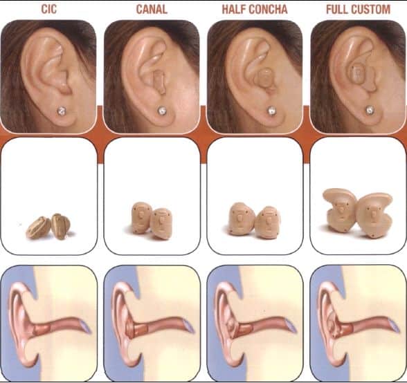 widex in ear hearing aids 1