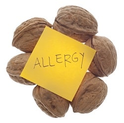 testing and treating allergies 5d39c15462a06