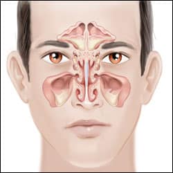 the symptoms of chronic sinusitis 5d39c2964eaaf